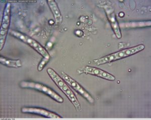 Microscopic images of Dothistroma