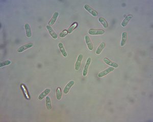 Gloeosporium spores