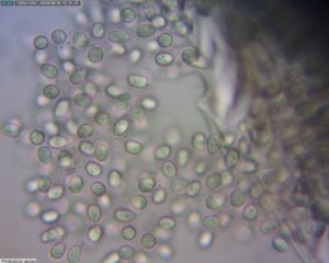 Phyllosticta spores
