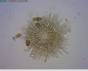 Pycnothyrium and conidia of Tubakia