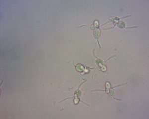 Microscopic image of Entomosporium conidia