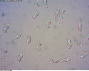 Microscopic image of Diplocarpon conidia