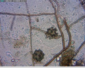 Ggg hyphae and hyphopodia as seen under the compound microscope